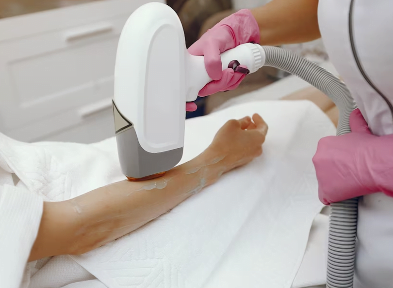 Laser Hair Removal